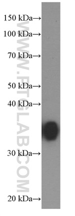 EEF1D Antibody in Western Blot (WB)