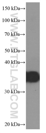 EEF1D Antibody in Western Blot (WB)