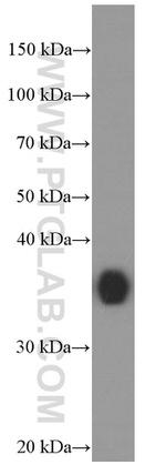 EEF1D Antibody in Western Blot (WB)