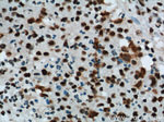 B23/NPM1 Antibody in Immunohistochemistry (Paraffin) (IHC (P))