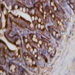 PCSK9 Antibody in Immunohistochemistry (Paraffin) (IHC (P))