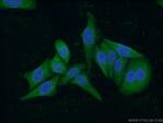 Neudesin/NENF Antibody in Immunocytochemistry (ICC/IF)