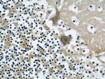 Neudesin/NENF Antibody in Immunohistochemistry (Paraffin) (IHC (P))