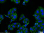 NR1H3 Antibody in Immunocytochemistry (ICC/IF)