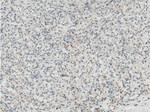 TEM1 Antibody in Immunohistochemistry (Paraffin) (IHC (P))