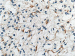 TEM1 Antibody in Immunohistochemistry (Paraffin) (IHC (P))