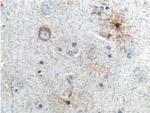 ALDH1A1 Antibody in Immunohistochemistry (Paraffin) (IHC (P))