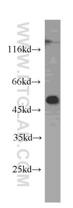 ALDH1A1 Antibody in Western Blot (WB)