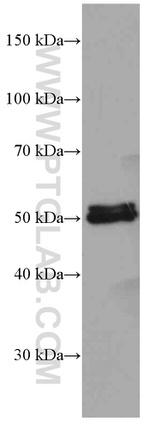 ALDH1A1 Antibody in Western Blot (WB)