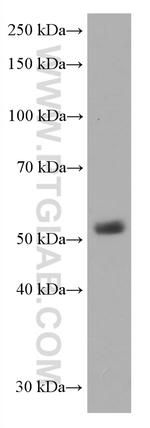 CD1A Antibody in Western Blot (WB)