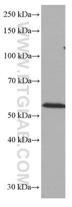 CD1A Antibody in Western Blot (WB)