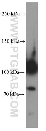 CD34 Antibody in Western Blot (WB)