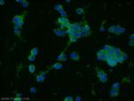 Synaptophysin Antibody in Immunocytochemistry (ICC/IF)