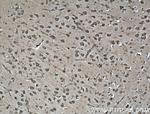 Synaptophysin Antibody in Immunohistochemistry (Paraffin) (IHC (P))