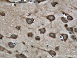 Synaptophysin Antibody in Immunohistochemistry (Paraffin) (IHC (P))