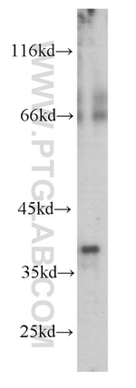 Synaptophysin Antibody in Western Blot (WB)