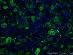 TNFR1 Antibody in Immunohistochemistry (PFA fixed) (IHC (PFA))