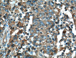 FAS/CD95 Antibody in Immunohistochemistry (Paraffin) (IHC (P))