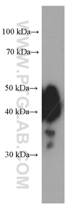 ESR2 Antibody in Western Blot (WB)