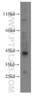 RXRA Antibody in Western Blot (WB)