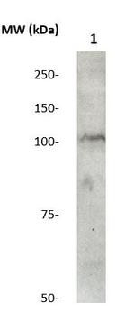 Catenin-Delta1 Antibody in Western Blot (WB)