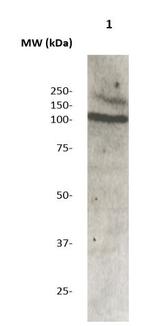 Phospho-Androgen Receptor (AR) (Ser210) Antibody in Western Blot (WB)