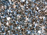 UBC9 Antibody in Immunohistochemistry (Paraffin) (IHC (P))