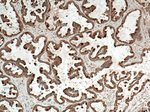 Galectin-3 Antibody in Immunohistochemistry (Paraffin) (IHC (P))