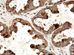 Galectin-3 Antibody in Immunohistochemistry (Paraffin) (IHC (P))