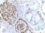 Galectin-3 Antibody in Immunohistochemistry (Paraffin) (IHC (P))