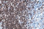 CD7 Antibody in Immunohistochemistry (Paraffin) (IHC (P))