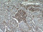 CD7 Antibody in Immunohistochemistry (Paraffin) (IHC (P))