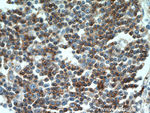 CD7 Antibody in Immunohistochemistry (Paraffin) (IHC (P))