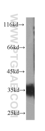 CD7 Antibody in Western Blot (WB)