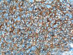 NCAM1/CD56 Antibody in Immunohistochemistry (Paraffin) (IHC (P))