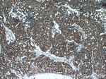 NCAM1/CD56 Antibody in Immunohistochemistry (Paraffin) (IHC (P))