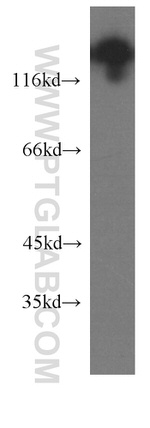 NCAM1/CD56 Antibody in Western Blot (WB)