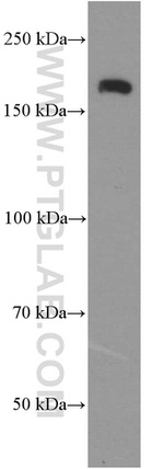 NCAM1/CD56 Antibody in Western Blot (WB)