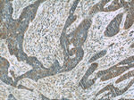 Cytokeratin 15 Antibody in Immunohistochemistry (Paraffin) (IHC (P))