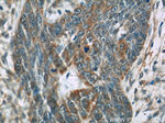 Cytokeratin 15 Antibody in Immunohistochemistry (Paraffin) (IHC (P))