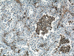 CD11c/Integrin alpha X Antibody in Immunohistochemistry (Paraffin) (IHC (P))