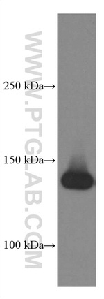 CD11c/Integrin alpha X Antibody in Western Blot (WB)