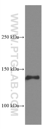 CD11c/Integrin alpha X Antibody in Western Blot (WB)