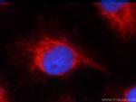 Napsin A Antibody in Immunocytochemistry (ICC/IF)