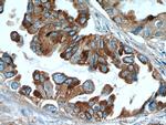 Napsin A Antibody in Immunohistochemistry (Paraffin) (IHC (P))