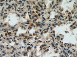 Napsin A Antibody in Immunohistochemistry (Paraffin) (IHC (P))