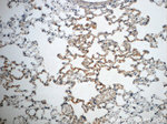 Napsin A Antibody in Immunohistochemistry (Paraffin) (IHC (P))