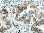 Napsin A Antibody in Immunohistochemistry (Paraffin) (IHC (P))