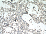 Napsin A Antibody in Immunohistochemistry (Paraffin) (IHC (P))