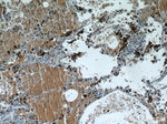 Napsin A Antibody in Immunohistochemistry (Paraffin) (IHC (P))